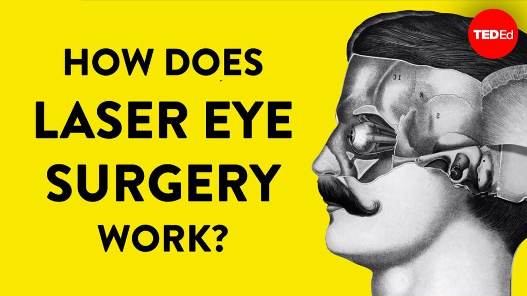 視力矯正の進化：角膜凍結からレーザー手術へ