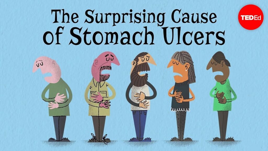 胃潰瘍の原因の革命的発見