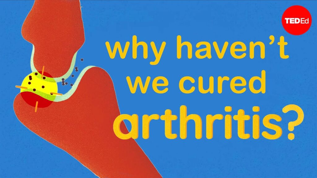 なぜ関節痛はおばあちゃんだけの問題ではないのか：関節痛の複雑性を理解する