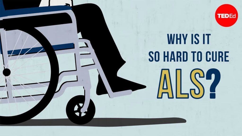 ALSの理解：数千人に影響を与える複雑で神秘的な病気の理解
