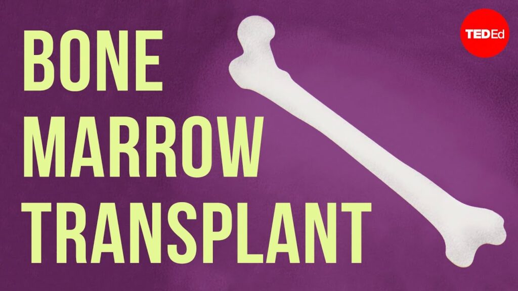 骨髄移植についての包括的FAQの理解